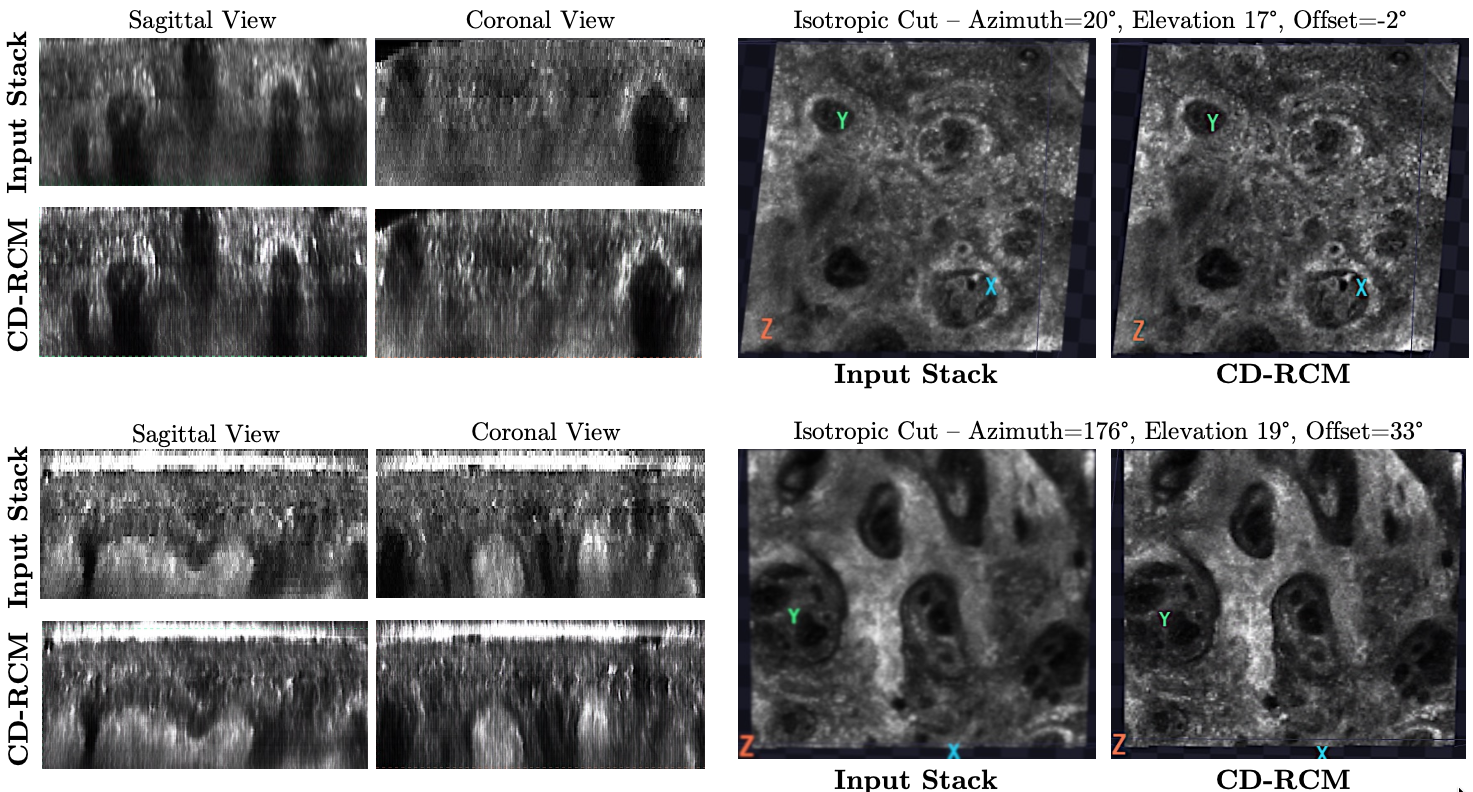 Sagittal, coronal and oblique cross-sections of input and CD-RCM-densified stacks
