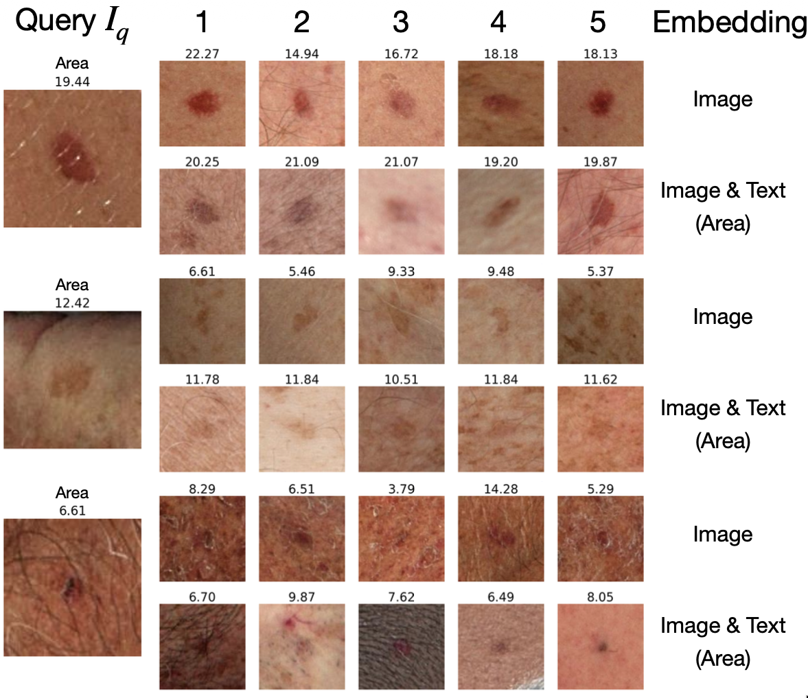 Top-5 retrieval results for image-only and area-conditioned embeddings