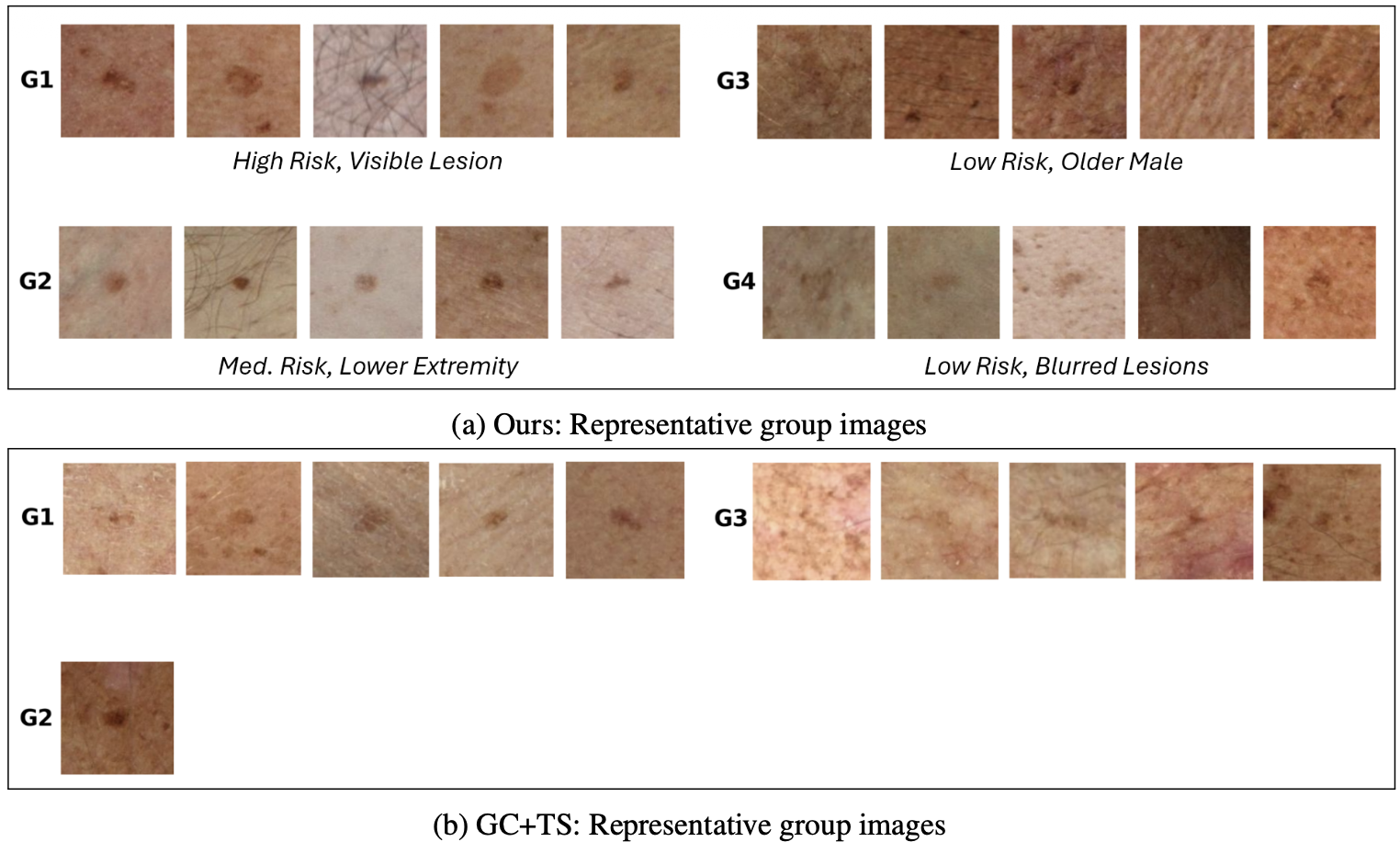 Representative images from the four groups SCC discovers on ISIC 2024